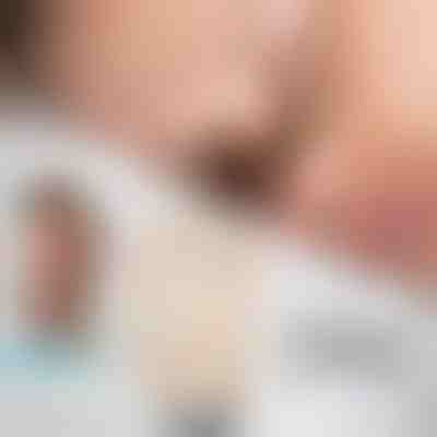 Dilatador nasal magnético | EASYBREATHE