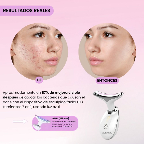 LUMEVAGLOW_18.4.2025_HANA_IMAGE_V13_1_1_ES__bbaf376b